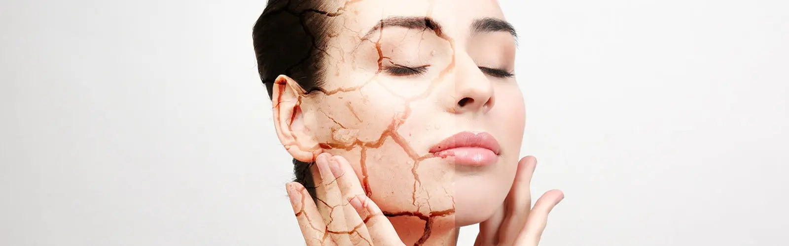 Tratamiento para la Piel Seca - Mylottush